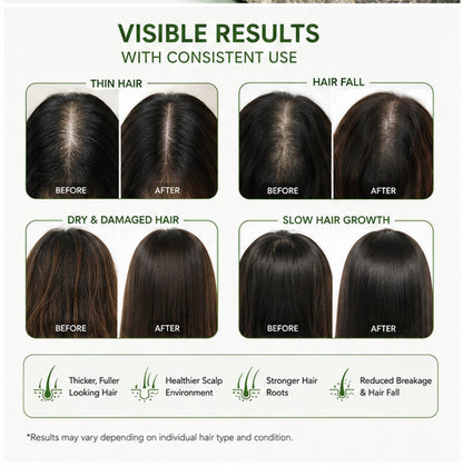 Natural Rosemary Hair & Scalp Growth Oil 100ml